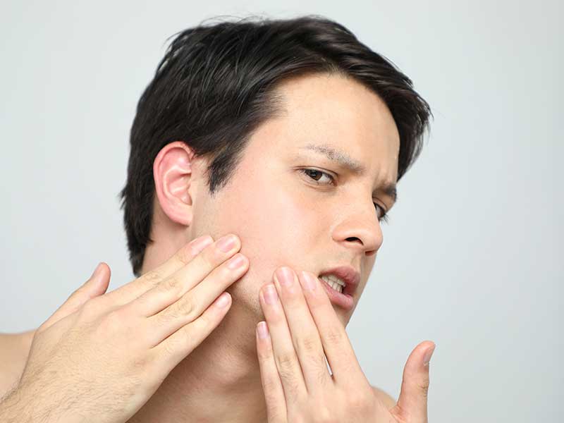 Breakouts Archives - SkinPhD